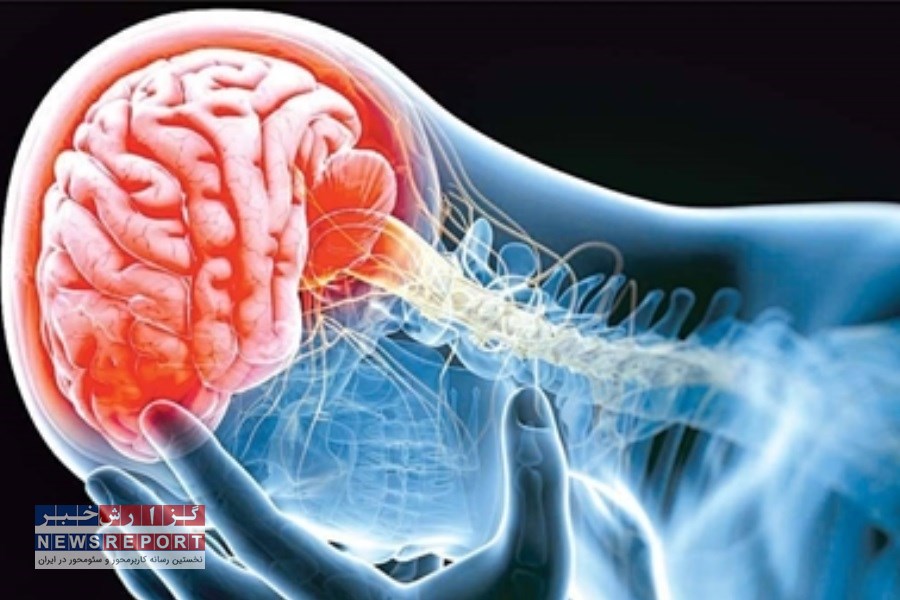 تشخیص سریع سکته مغزی: نشانه‌های حیاتی را بشناسید